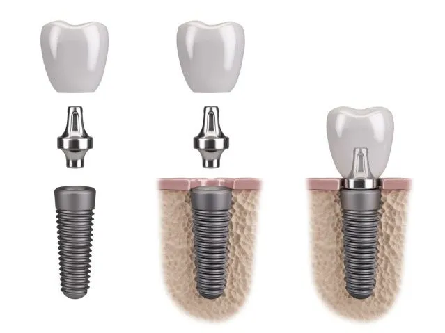 Dr. Firas F. Katabi, Oral Surgeon