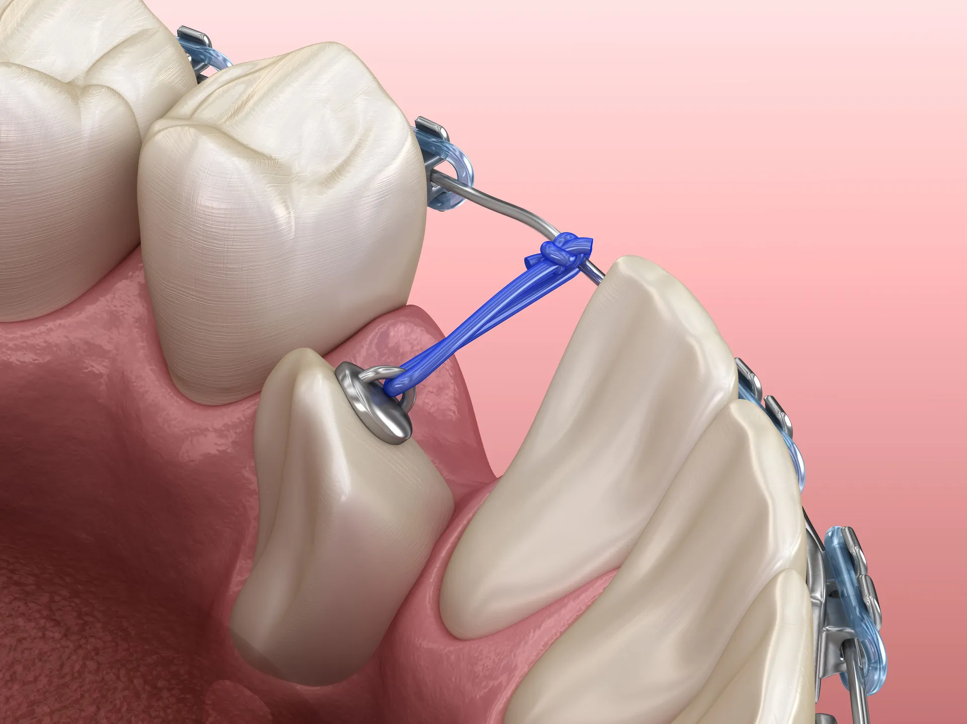 Dr. Firas F. Katabi, Oral Surgeon
